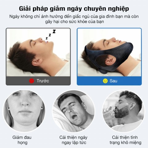 Dây đeo cằm chống ngáy