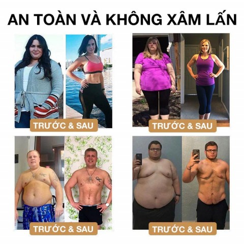 Vòng đeo tay siêu âm định hình cơ thể